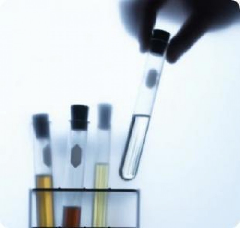 Farmaco anti-mesotelioma? Già in uso per la gotta e - secondo un ricercatore di Losanna - utile anche nelle patologie da amianto