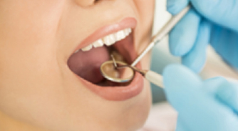 L’Oral Cancer Day a Casale, prevenzione del tumore del cavo orale