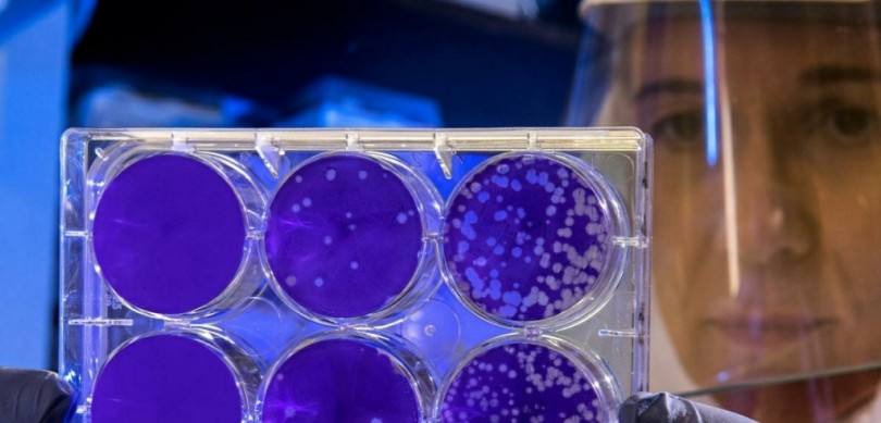 Coronavirus: 26.550 pazienti guariti, 4142 decessi, 32.169 i contagi complessivi