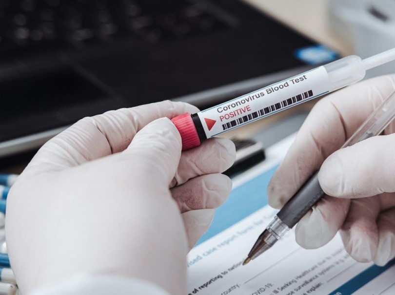 Coronavirus: al via lunedì i test  sierologici sul personale sanitario regionale