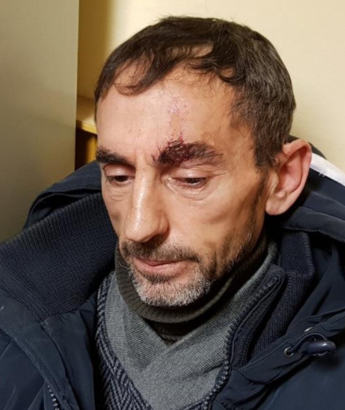 Inchiodato il rapinatore 