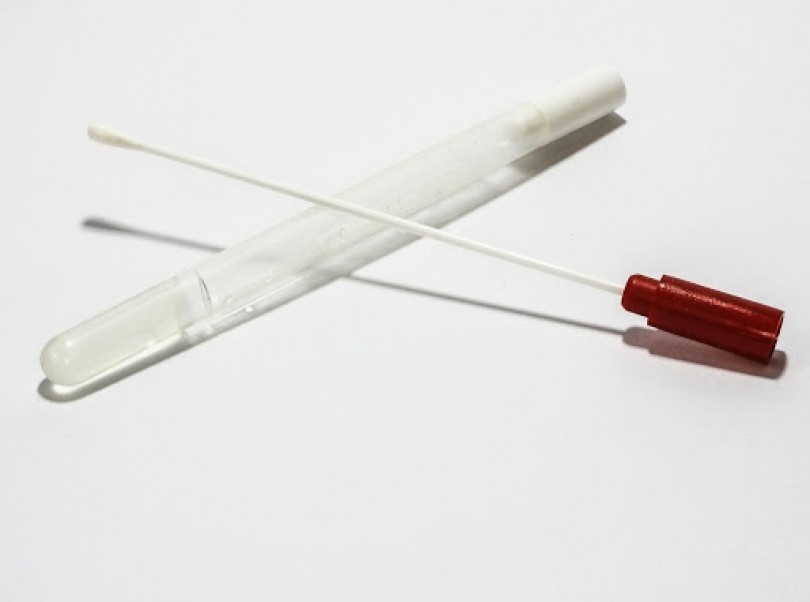 Tamponi nelle RSA: le precisazioni dell'assessore Caucino